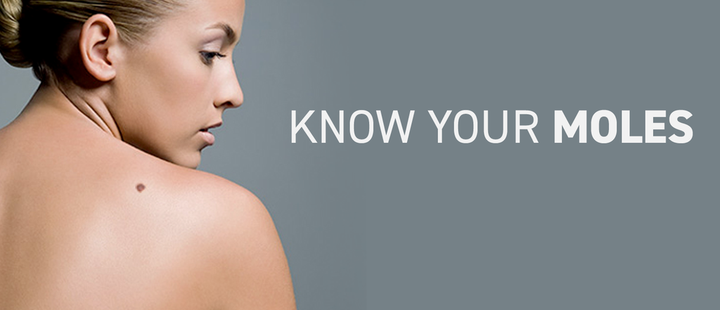 The ABCDEs of Melanoma