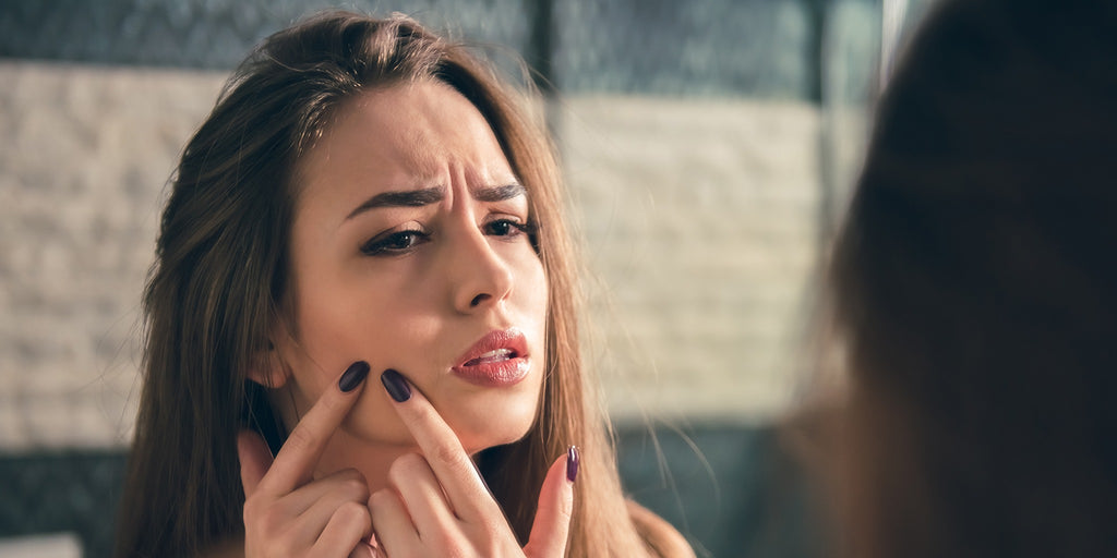 Here’s Exactly How to Get Rid of a Pimple Overnight