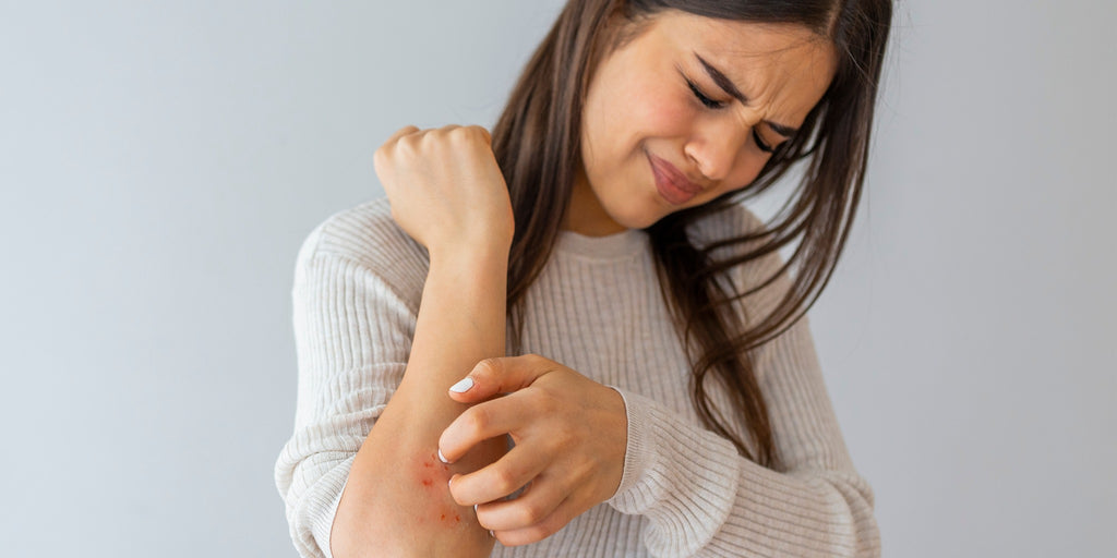 The 6 Best Psoriasis Creams and Lotions, According to Dermatologists