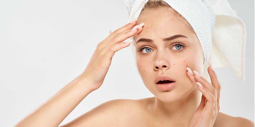 How To Treat Cystic Acne In Your 30s, And Get Results