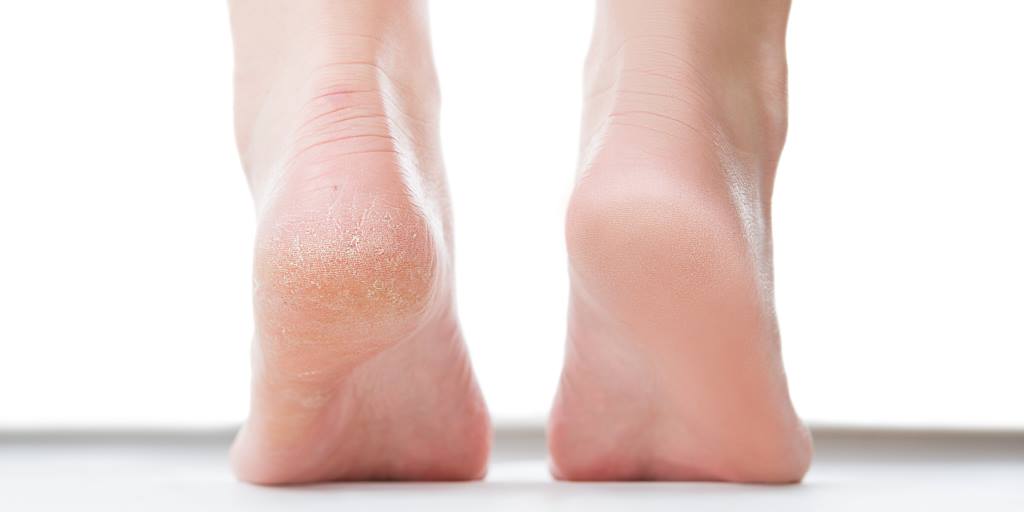 10 Genius Solutions for All of Your Winter Skin-Care Problems