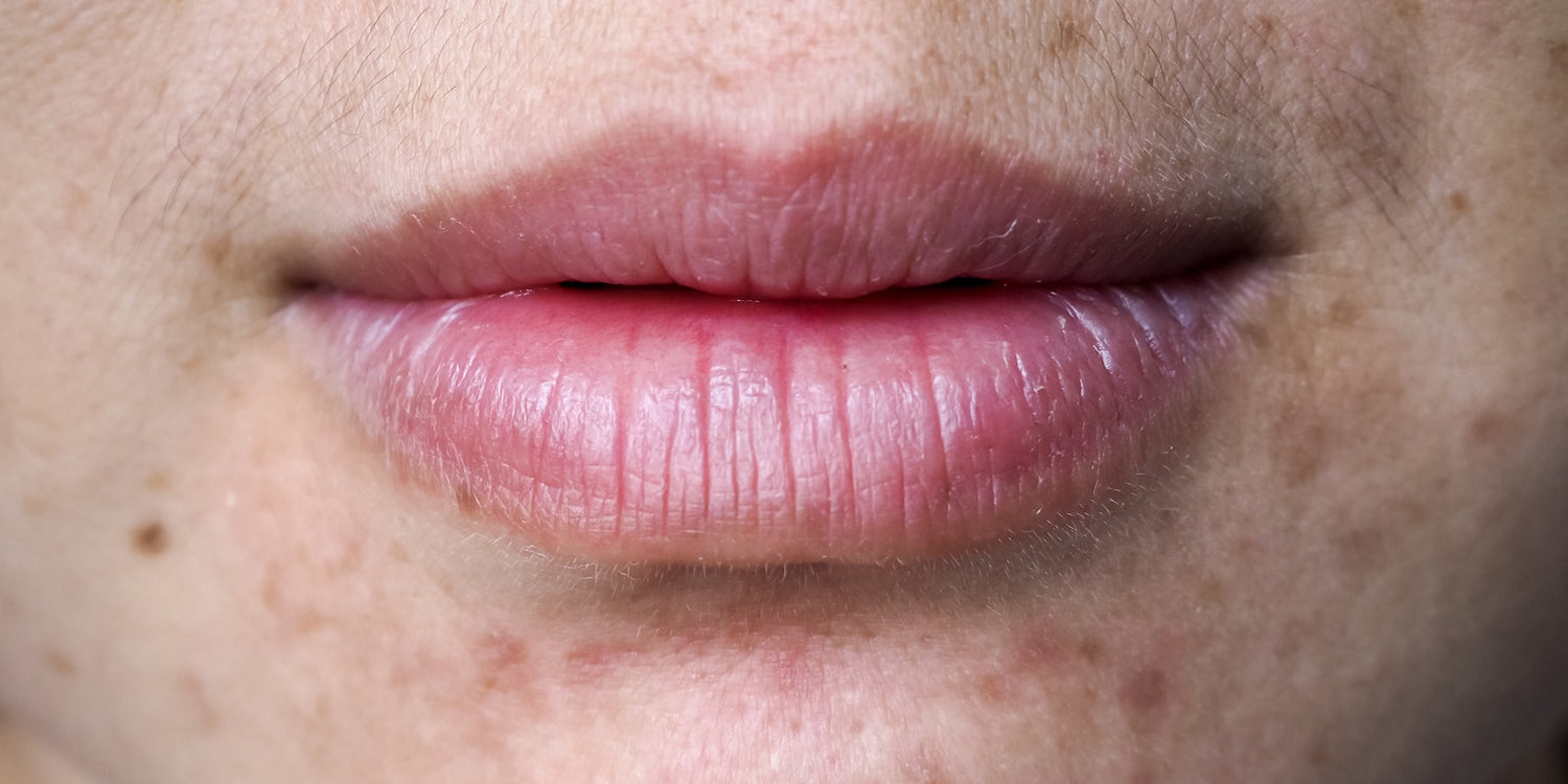 Dermatologists Say This $15 Shampoo Could Clear Your Fungal Acne