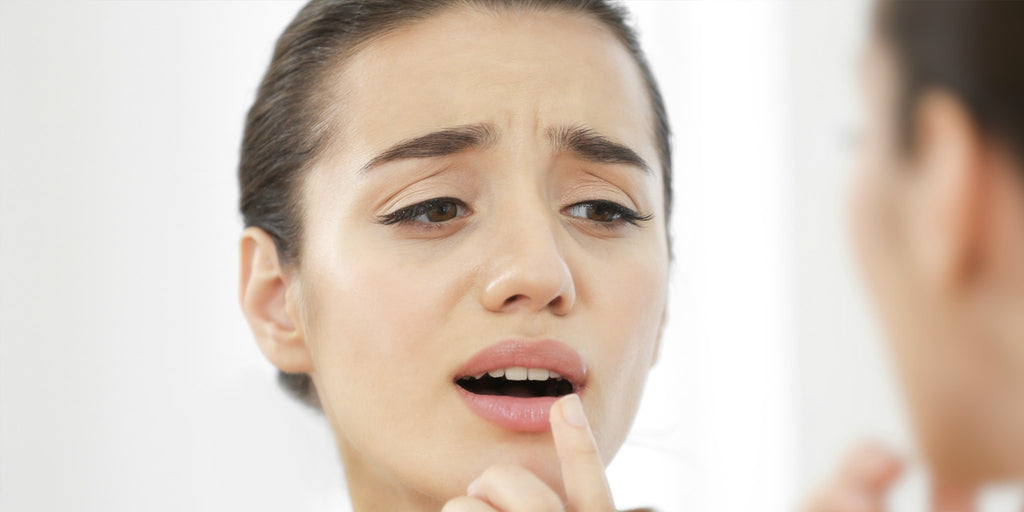 Cold Sores Versus Pimples: Which One Do You Have & How To Get Rid Of Them Both