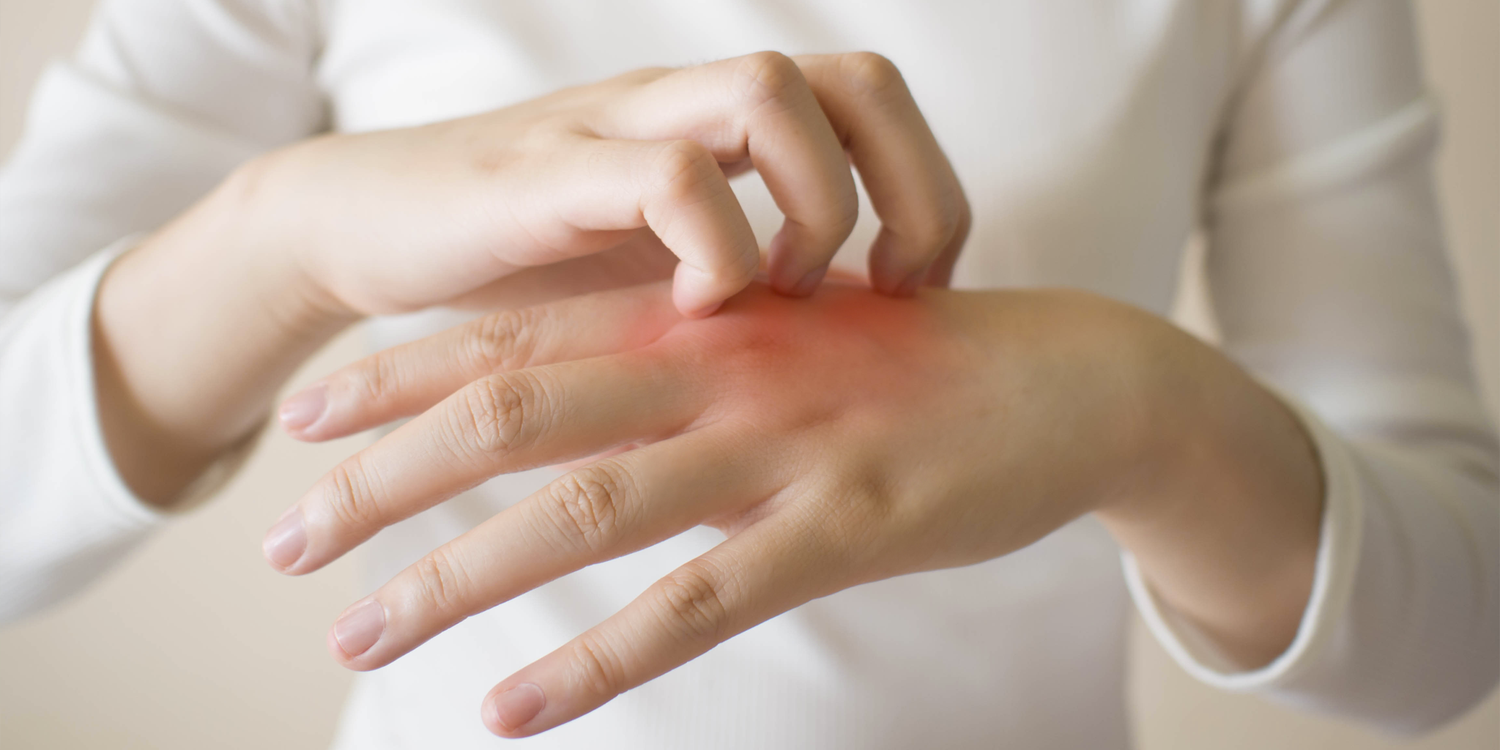 When to Call Your Dermatologist About Hand Dermatitis