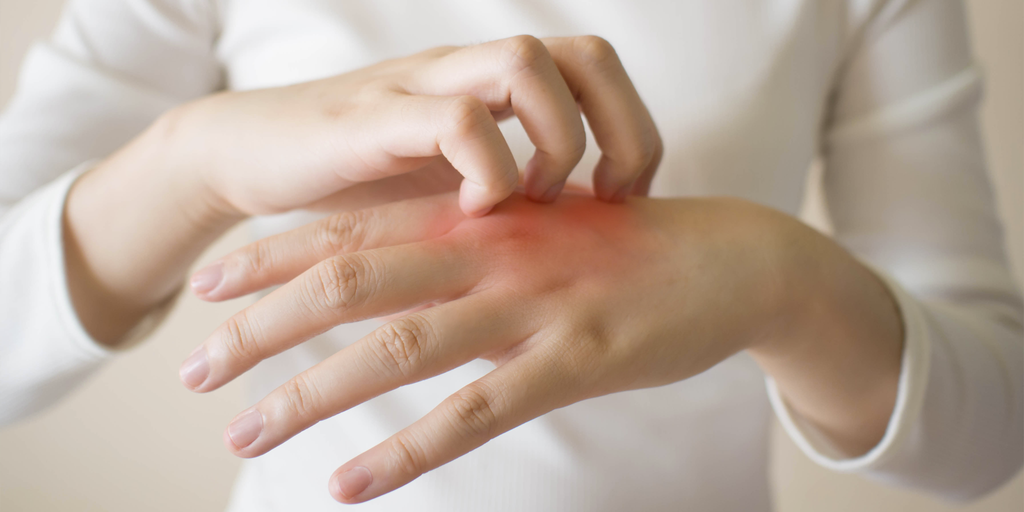 When to Call Your Dermatologist About Hand Dermatitis