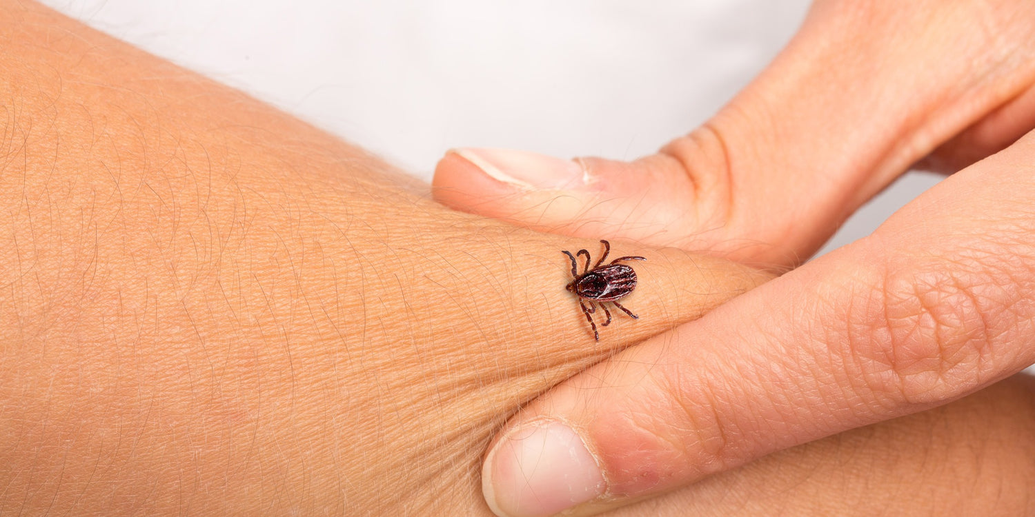 The 3 Surprising Body Parts You Need to Check for Ticks, Experts Say