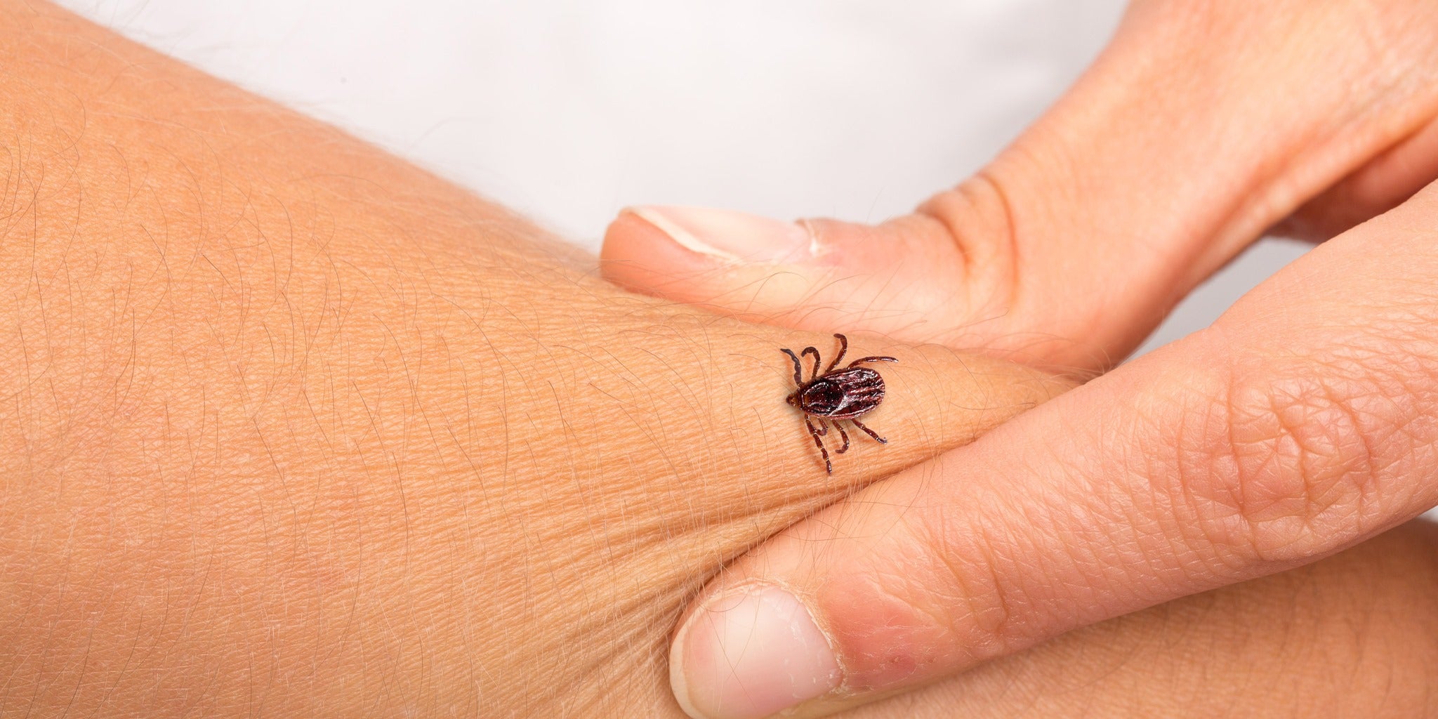 The 3 Surprising Body Parts You Need to Check for Ticks, Experts Say
