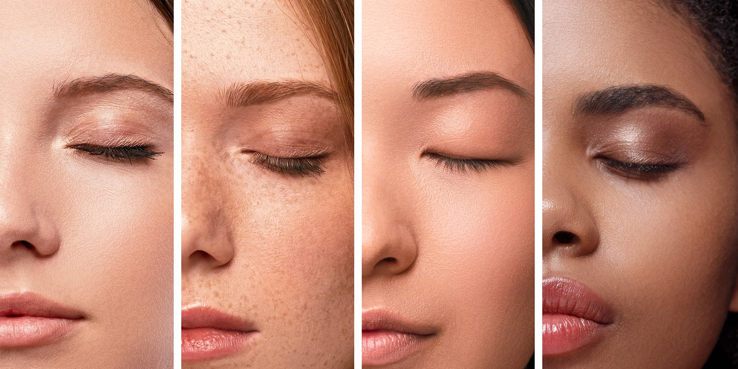 Dermatology Has a Race Gap. Here’s How to Get Good Treatment Anyway