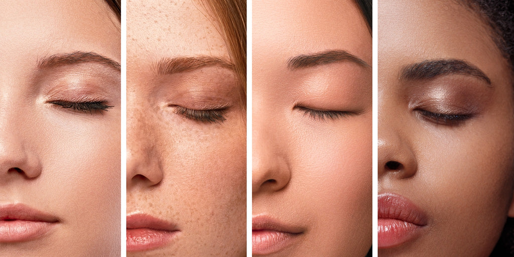 Dermatology Has a Race Gap. Here’s How to Get Good Treatment Anyway